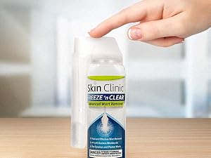 How To Use the FREEZE 'n CLEAR Wart Remover