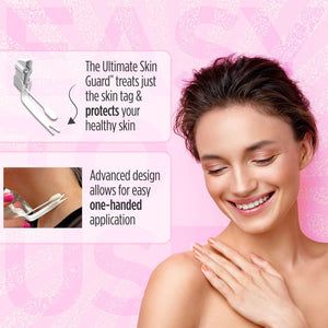 The Ultimate Skin Tag Removal Kit with Post Treatment Serum