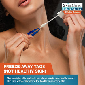 FREEZE 'n CLEAR Skin Tag Remover