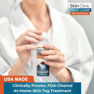 FREEZE 'n CLEAR Skin Tag Remover
