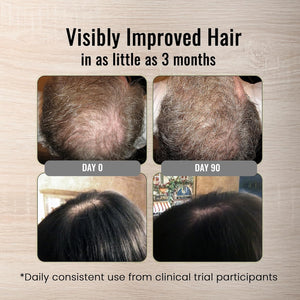 Once Daily Hair Loss Support Tablet