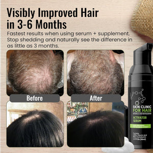 Skin Clinic for Hair Botanical Hair Loss Foaming Serum