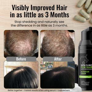 Skin Clinic for Hair Serum and Tablet Kit