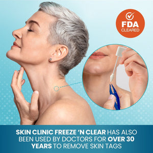 FREEZE 'n CLEAR Skin Tag Remover
