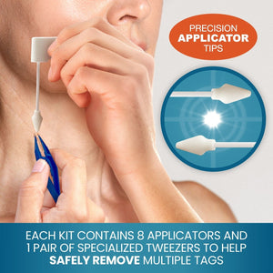 FREEZE 'n CLEAR Skin Tag Remover